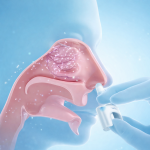 Adrenaline nasal spray inserted into a person’s nostril, with a semi-transparent side view revealing the nasal cavity and fine particles dispersing inside