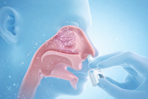 Adrenaline nasal spray inserted into a person’s nostril, with a semi-transparent side view revealing the nasal cavity and fine particles dispersing inside